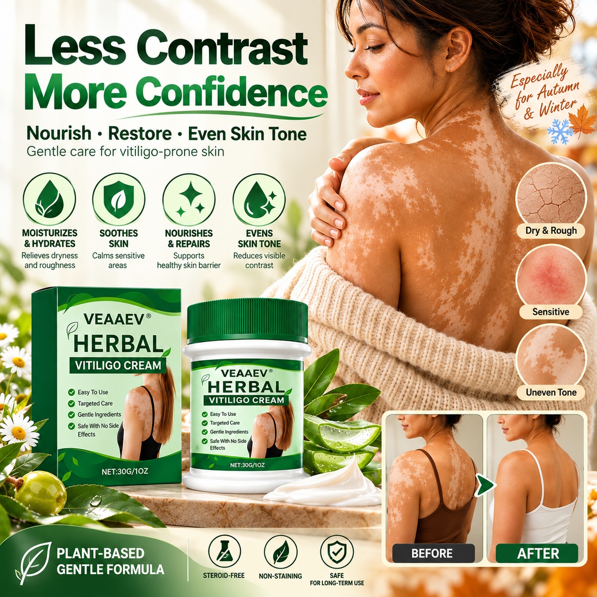 VEAAEV® Herbal Vitiligo Cream