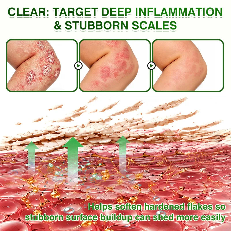 VEAAEV® SkinRecovery Reishi Botanical Skin Comfort Spray