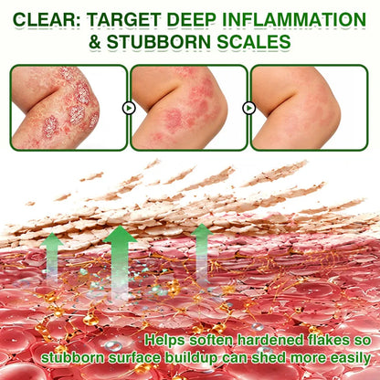 VEAAEV® SkinRecovery Reishi Botanical Skin Comfort Spray