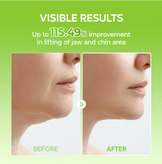🎊BIG SALE🎊V-LIFTING MEWING BAND with Cactus Cooling Reduce Puffiness & Pore Tightening for Visible Pore Care Skin Repair