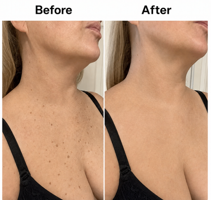 🔥 BUY 1 GET 1 FREE — Smooth & Even Glycolic Body Stick