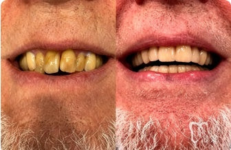 Customer-submitted before and after dental images