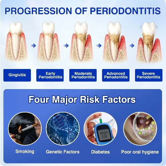 Illustration showing progression of periodontitis and common risk factors