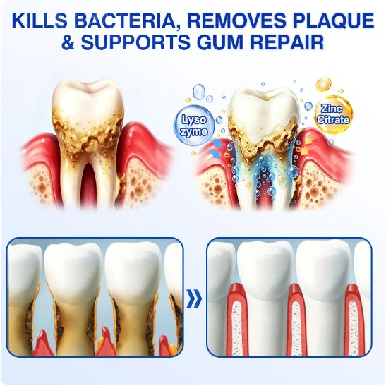 Illustration showing plaque build-up, targeted gum-line application and cleaner tooth surfaces