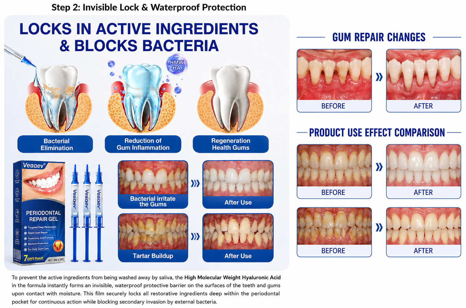 Veaaev gum care and periodontal repair comparison